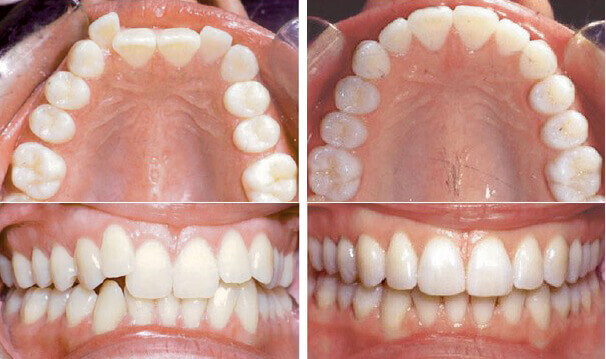 Orthodontics