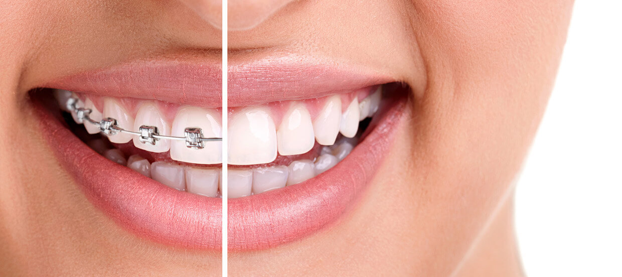 Orthodontics